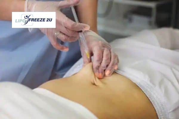 How Does Aqualyx Fat Dissolving Injection Work to Break Down Fat Little Bognor?
