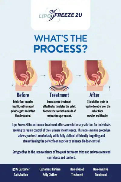 Diagram of how incontinence treatment Little Bognor works.