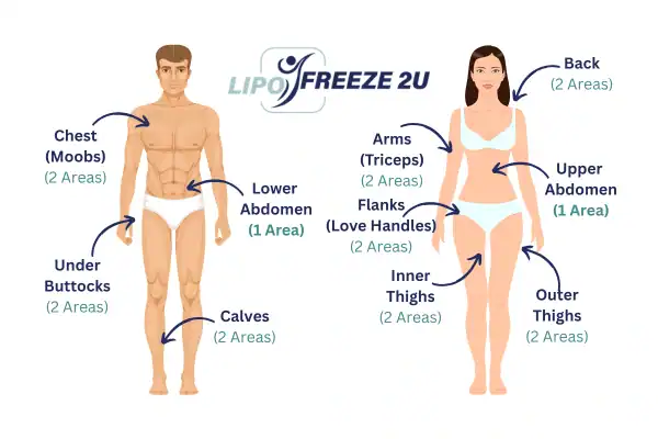 Areas you can have fat freezing treatment Little Bognor