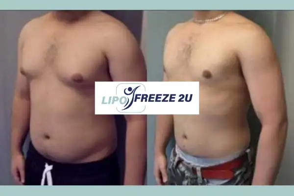 How Long Does It Take to See Results Little Bognor?