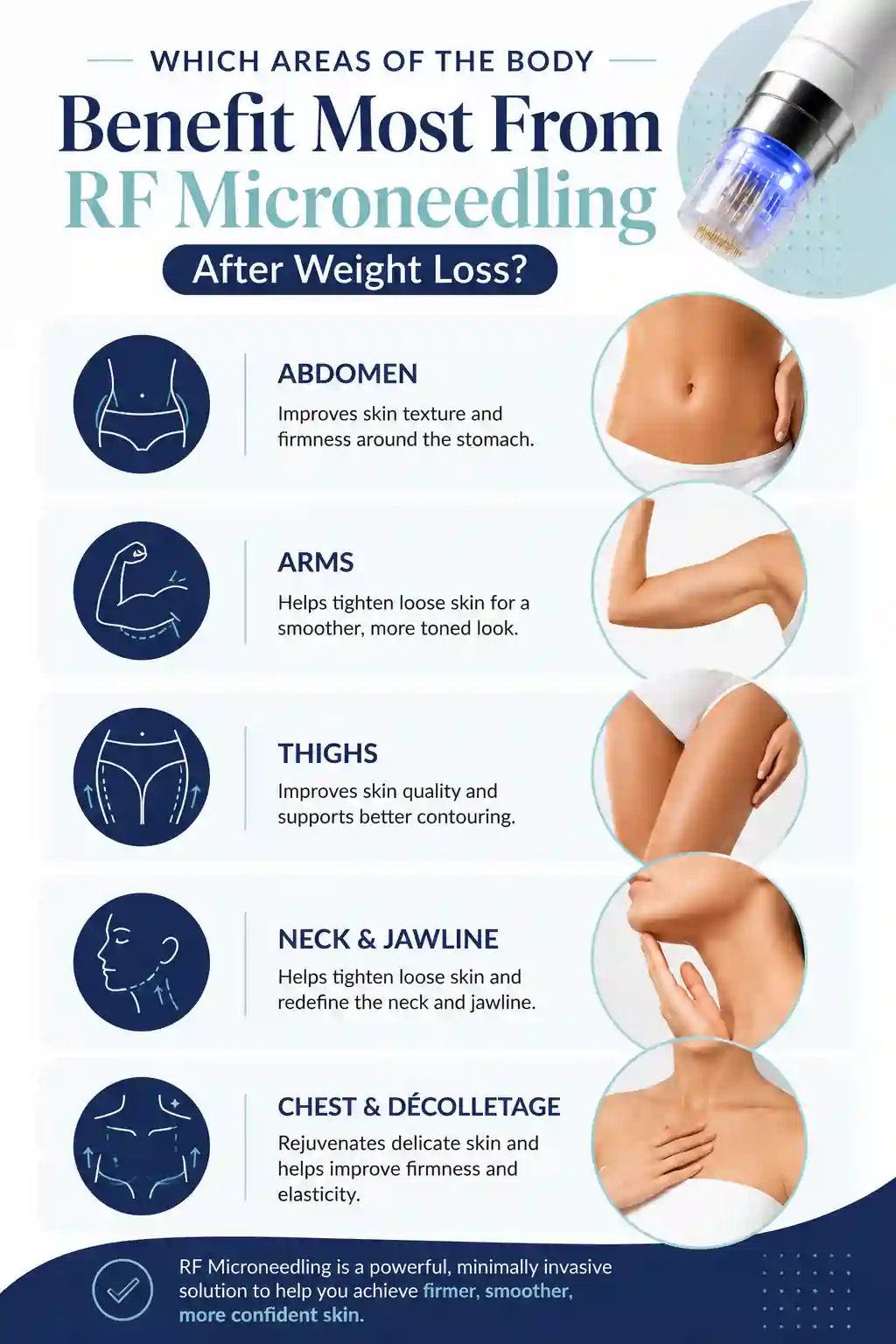 Which Areas of the Body Benefit Most From RF Microneedling After Weight Loss Little Bognor